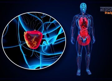 Tumore della prostata: in Italia registrati 40.000 nuovi casi all'anno