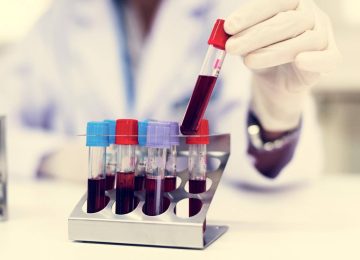 Le piastrine influenzano memoria e comportamento: ecco come. La scoperta.