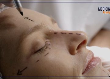 Rinoplastica: L'importanza di correggere un naso invecchiato