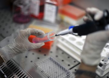 Scoperti i Codici del Sistema Immunitario per Interrompere le Terapie Contro l'HIV