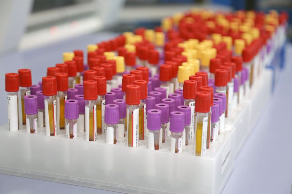 "Attenzione alle conserve domestiche" - Meo Botulino (Artemisia Lab) per l'Agenzia Italpress
