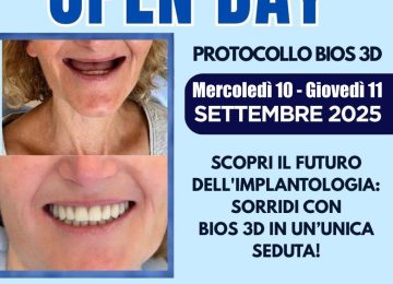 Tornano il 10 e 11 settembre gli open days di Bios32: denti fissi in 24 ore!
