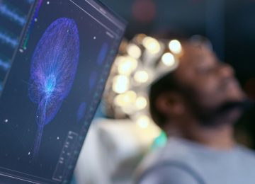 Tumori cerebrali: la Toscana guida la ricerca con SeqPerGlio, un innovativo progetto europeo per migliorare la cura del glioblastoma