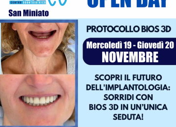 Tornano il 19 e 20 novembre gli open days con Bios32: denti fissi in 24 ore!