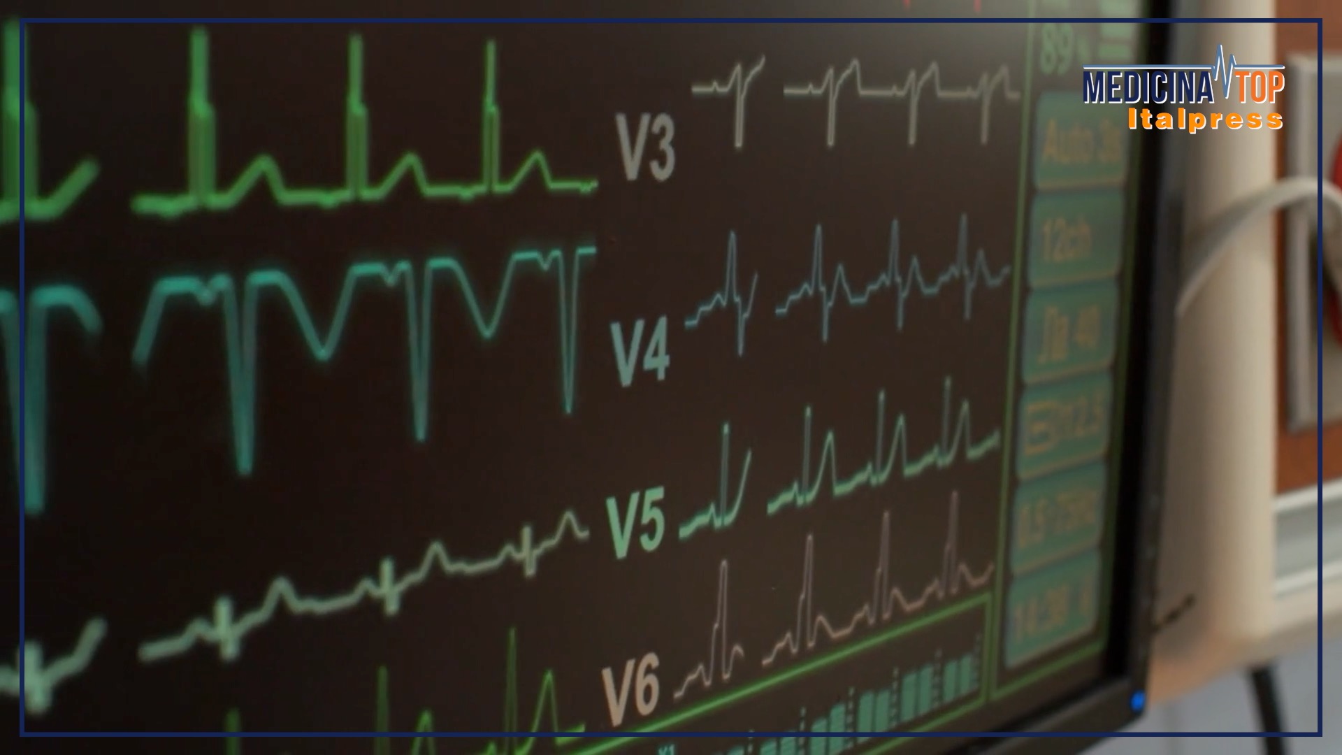 In Italia si registrano 100.000 casi di ictus all'anno: prevenzione e trattamento possono cambiare la situazione.
