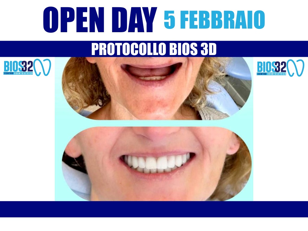 Torna giovedì 5 febbraio l'open day con Bios32: denti fissi in sole 24 ore!