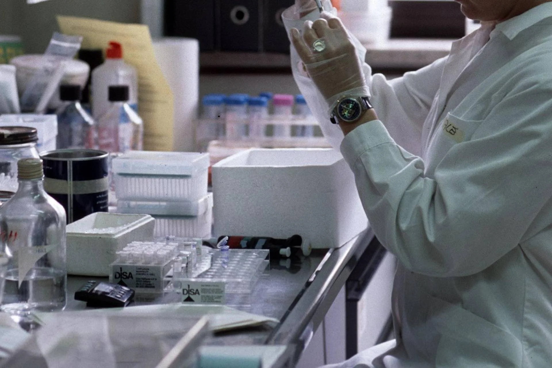 Malattie rare: Fenilchetonuria, Cazzorla (A.O. Padova): "Migliore qualità di vita grazie a nuove cure"