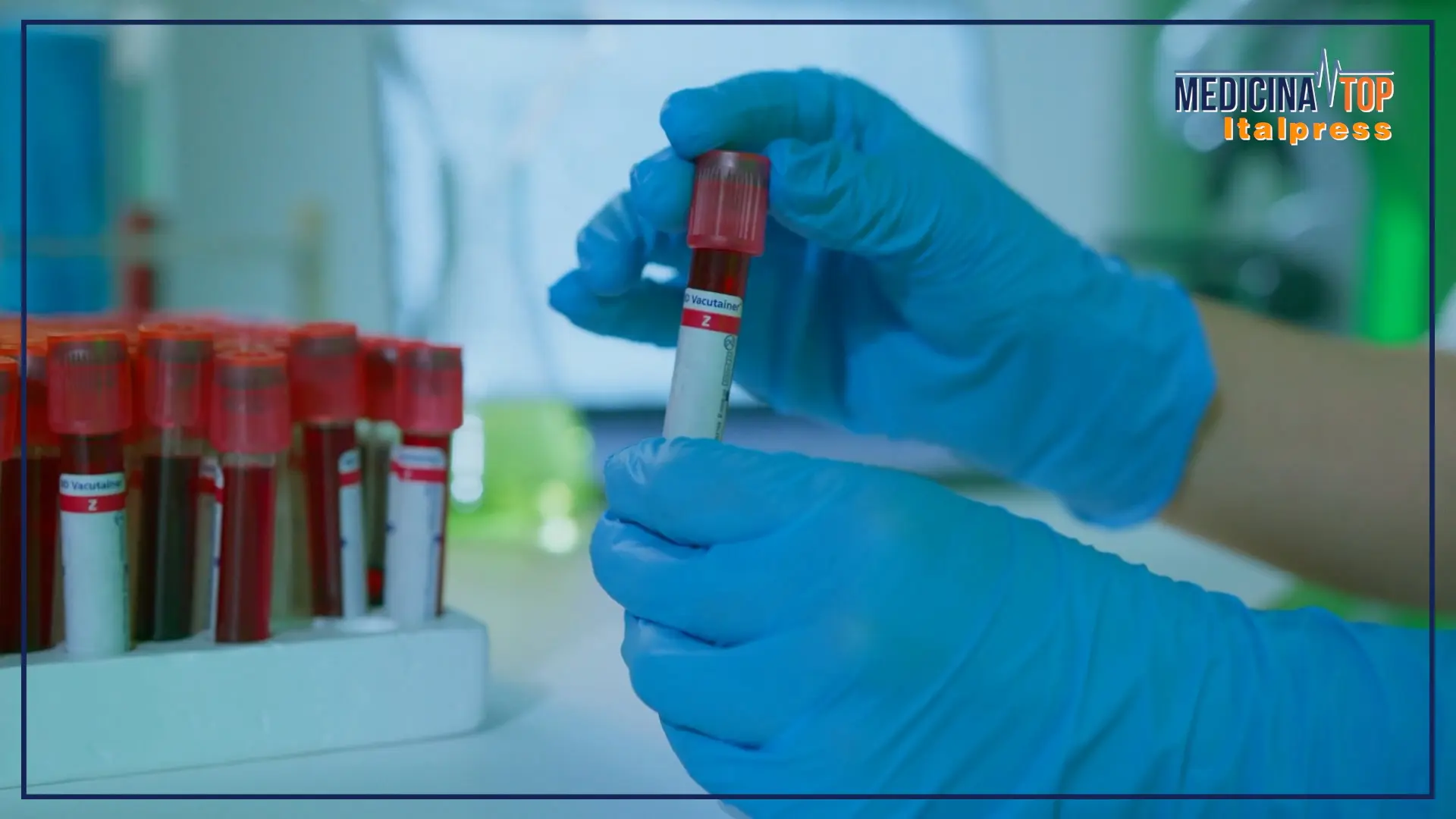 Donazione di sangue: l'Italia raggiunge l'autosufficienza, ma servono progressi sul plasma.