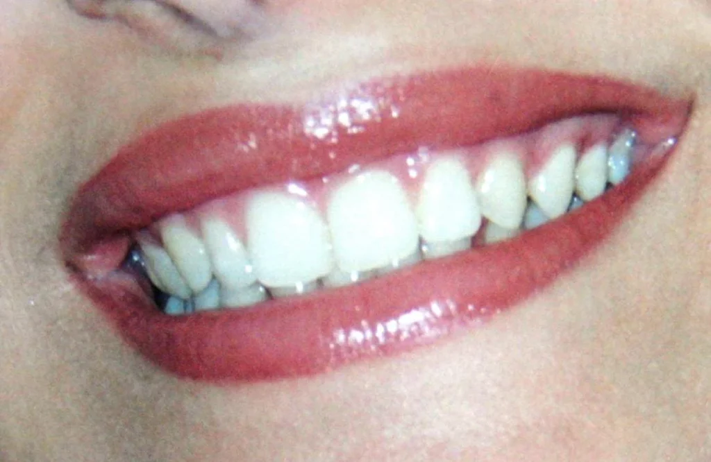 Dentista senza appuntamento a Roma: visite immediate per urgenze e controlli all'Isola Tiberina