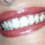 Dentista senza appuntamento a Roma: visite immediate per urgenze e controlli all'Isola Tiberina
