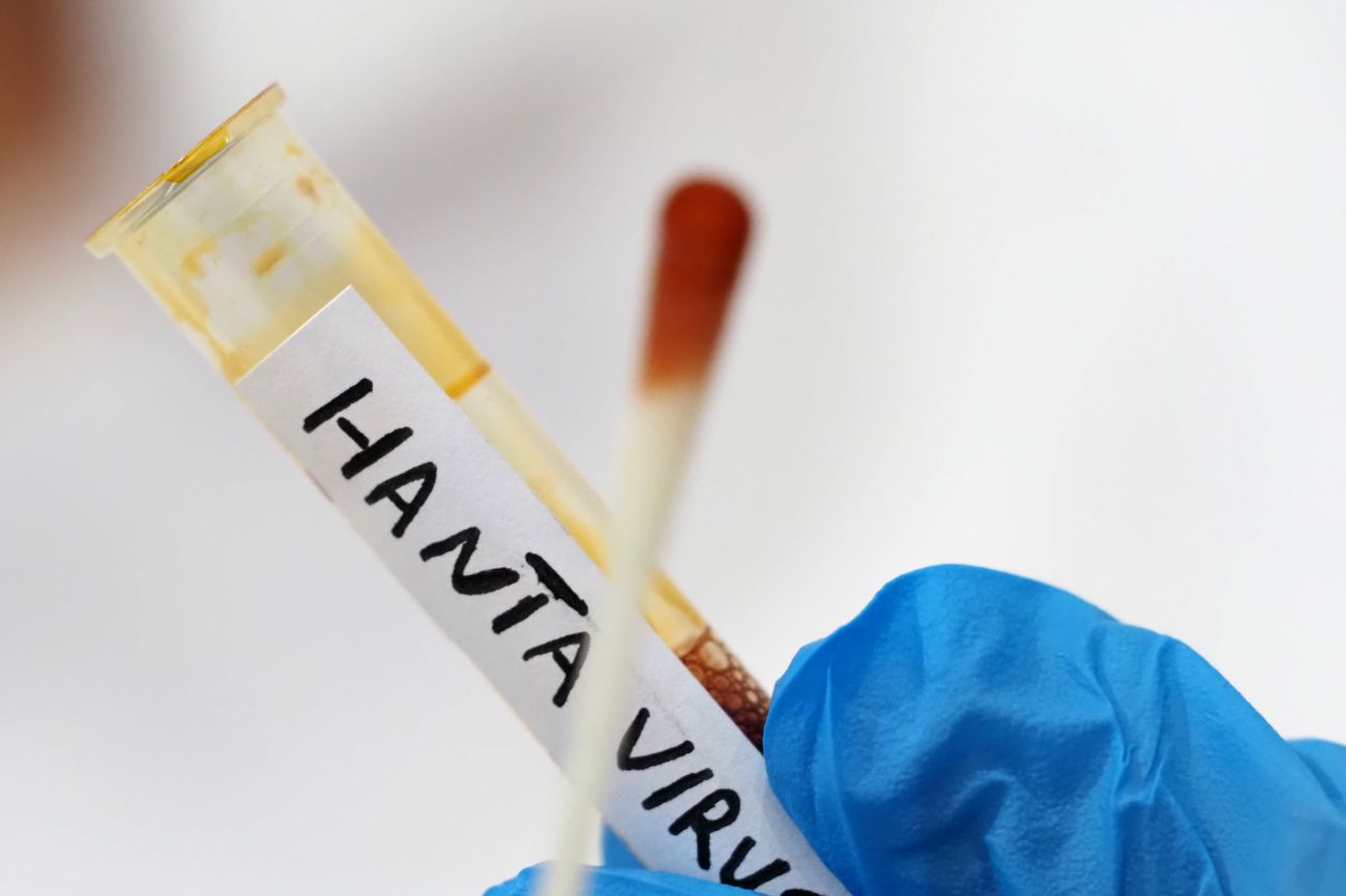 Hantavirus, il Ministero della Salute conferma: “Non risultano casi registrati in Italia”