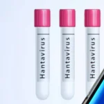 Hantavirus può provocare una pandemia? La risposta in uno studio.