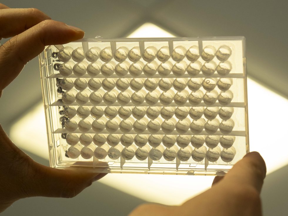 La Sardegna lancia il programma di screening neonatale per la SMA